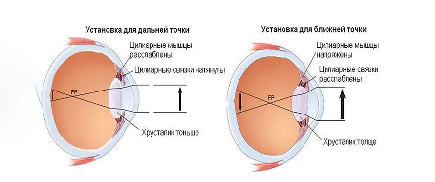 Как работает аккомодация глаза